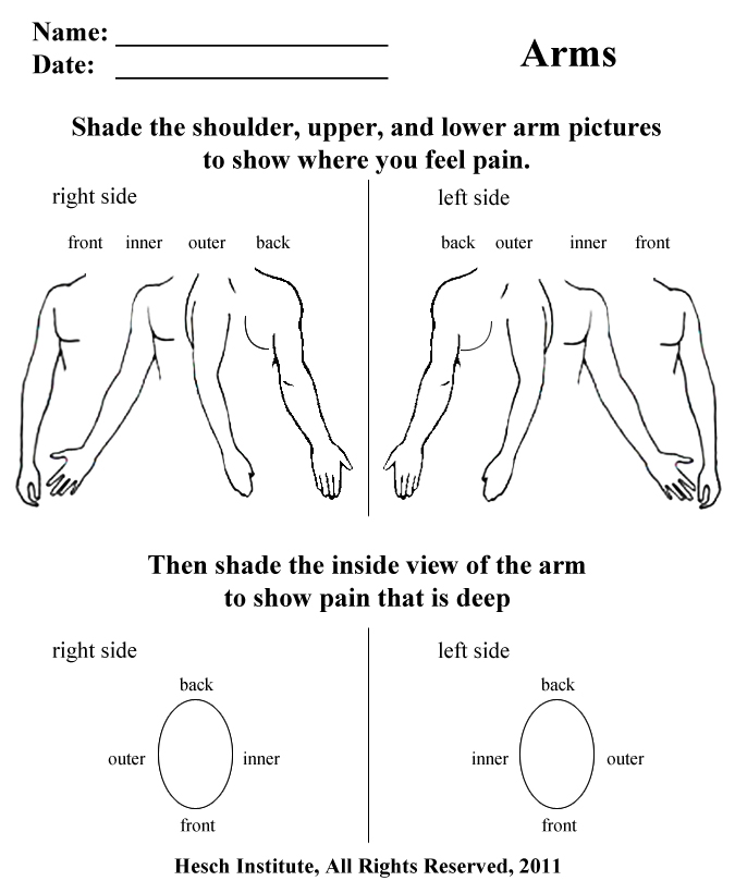 arms